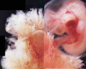 Embryo-placentaLow